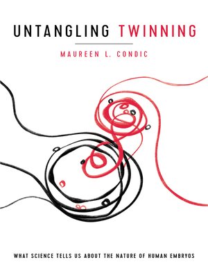 cover image of Untangling Twinning